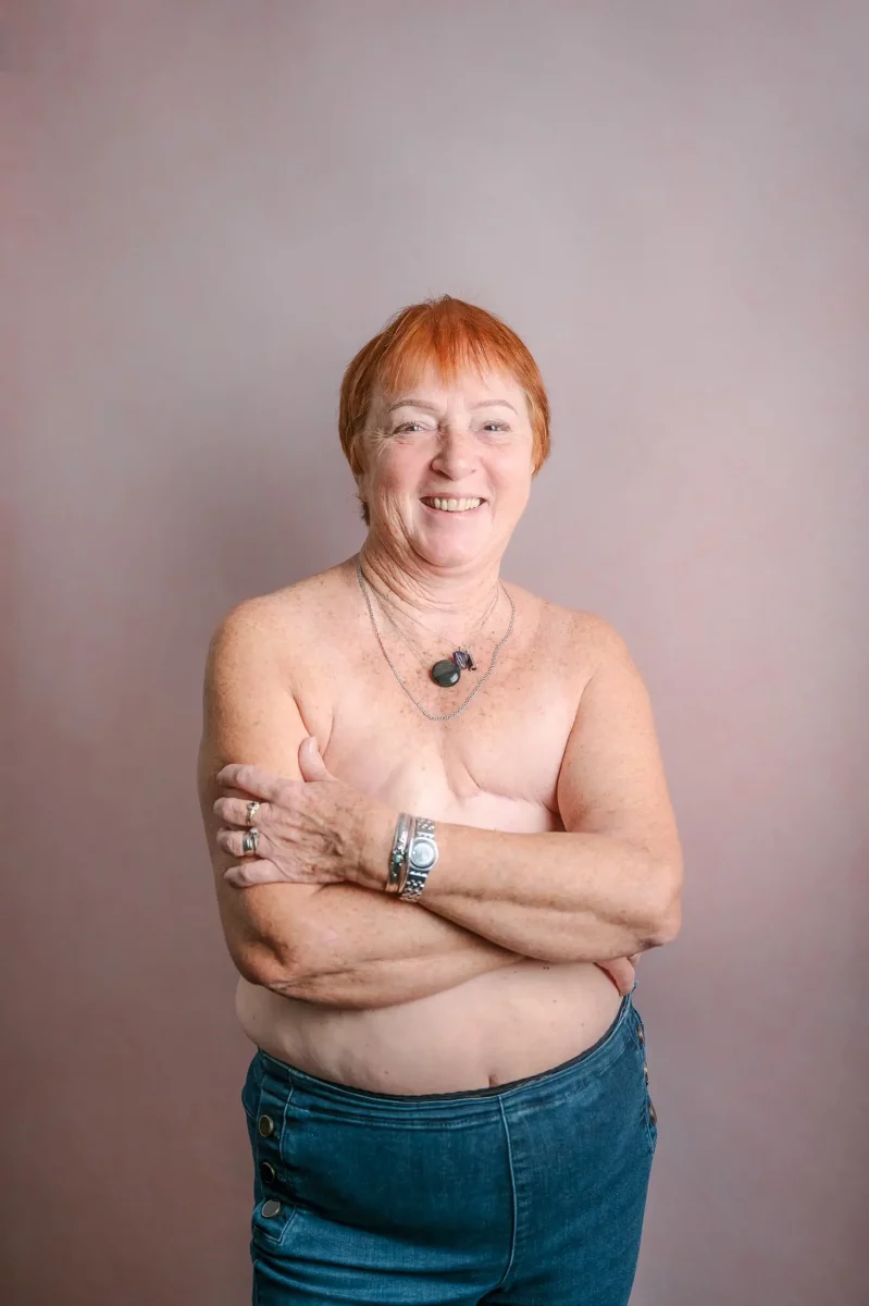 photographe-apres-mastectomie-cancer-du-sein-annette-agnes-colombo-1